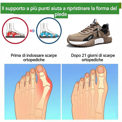 CHARHAL® | Sconto del 50% oggi - Non lasciartelo sfuggire! Scarpe ortopediche dal design ergonomico - morbide e comode ✅ (supporto dell'arco plantare, supporto per la camminata)