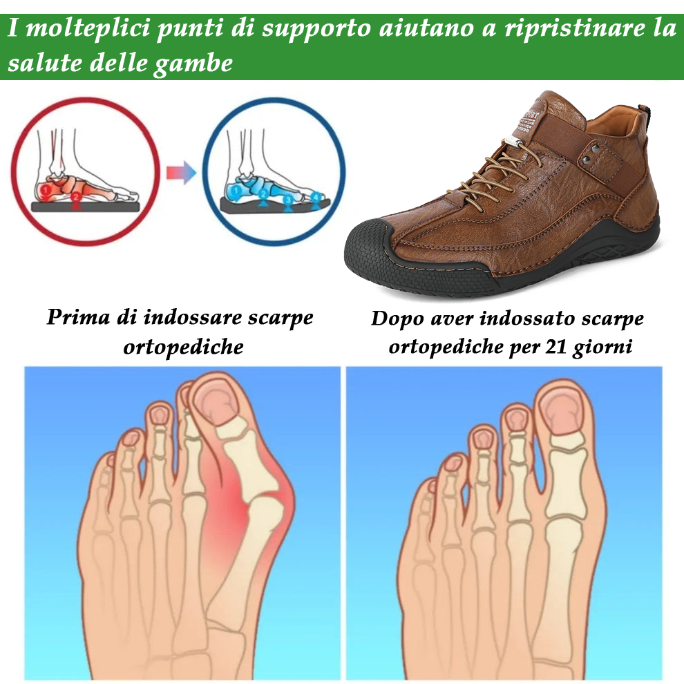 (🔥Sconto del 50% oggi - Non lasciartelo sfuggire!) - 🐂Scarpe comode ed eleganti in pelle di vitello 👞(antiscivolo, supporto plantare per alleviare il dolore)